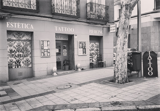 Servicios de eliminación de tatuajes en Madrid